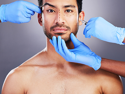 Why Men Hair Transplant
